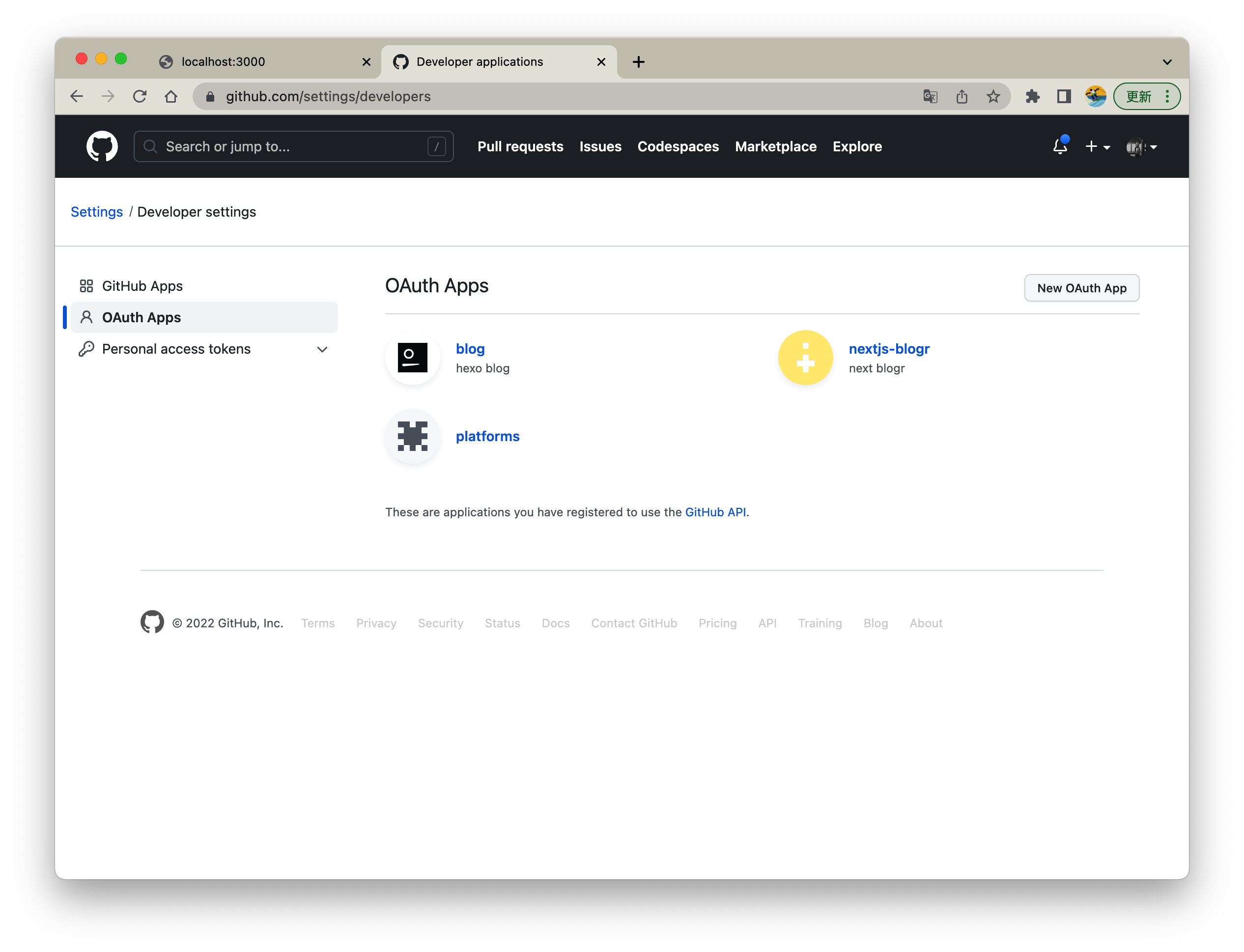 Next NextAuth Prisma Blog